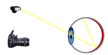 Flash déporté et yeux rouges